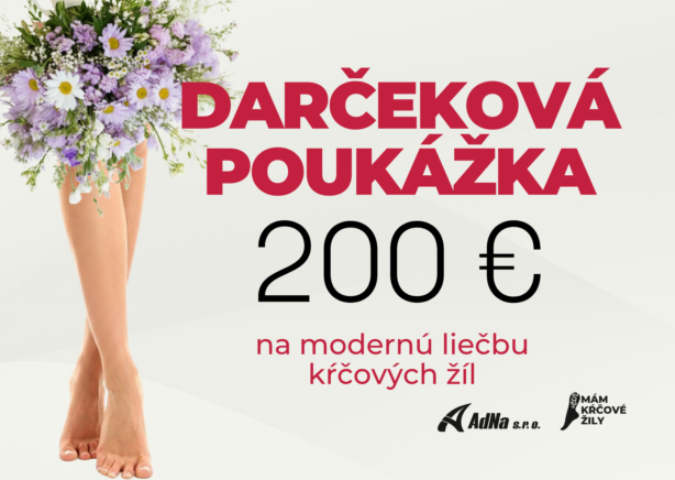 Darčeková poukážka 200€ na komplexné vstupné vyšetrenie a modernú liečbu kŕčových žíl v Košiciach.